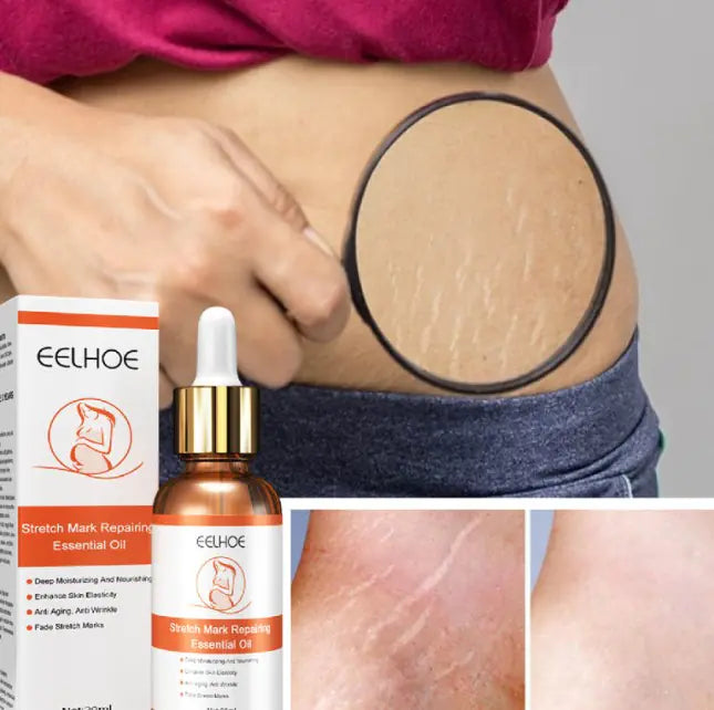 Scar Repairing Essential Oil - Merch & Gadgets online